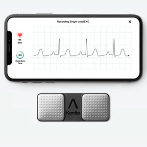 Kardia by AliveCor - KardiaMobile 1-Lead Personal ECG Monitor - Detects AFib