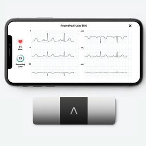Kardia by AliveCor - KardiaMobile 6L Six-Lead Personal ECG Monitor - Detects AFib